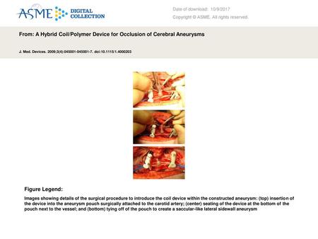 From: A Hybrid Coil/Polymer Device for Occlusion of Cerebral Aneurysms