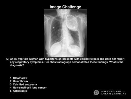 Image Challenge Q: An 86-year-old woman with hypertension presents with epigastric pain and does not report any respiratory symptoms. Her chest radiograph.