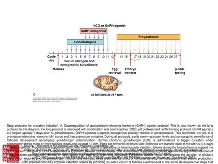 Drug protocols for ovulation induction. A