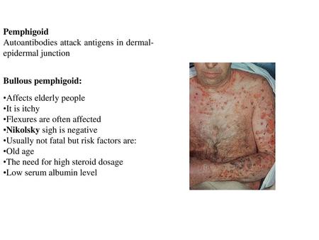 Pemphigoid Autoantibodies attack antigens in dermal-epidermal junction