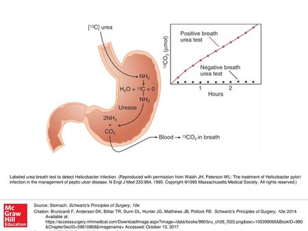 Labeled urea breath test to detect Helicobacter infection