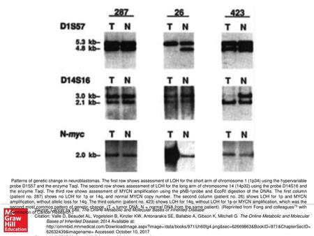 Patterns of genetic change in neuroblastomas