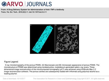 From: A Drug Delivery System for Administration of Anti–TNF-α Antibody