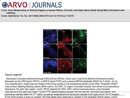 From: Inter-Relationship of Arterial Supply to Human Retina, Choroid, and Optic Nerve Head Using Micro Perfusion and Labeling Invest. Ophthalmol. Vis.