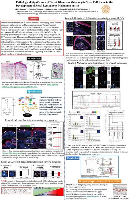 Pathological Significance of Sweat Glands as Melanocytic Stem Cell Niche in the Development of Acral Lentiginous Melanoma in situ Go J. Yoshida 1), Natsuko.