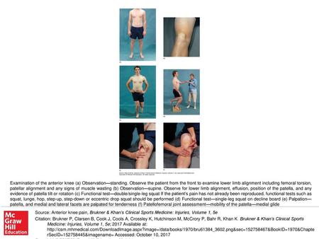 Examination of the anterior knee (a) Observation—standing