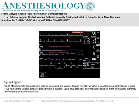 Anesthes. 2012;117(1): doi: /ALN.0b013e Figure Legend: