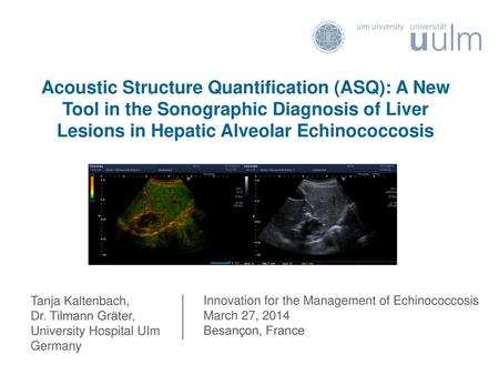 Acoustic Structure Quantification (ASQ): A New Tool in the Sonographic Diagnosis of Liver Lesions in Hepatic Alveolar Echinococcosis Tanja Kaltenbach,