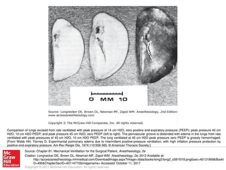 Comparison of lungs excised from rats ventilated with peak pressure of 14 cm H2O, zero positive end-expiratory pressure (PEEP); peak pressure 45 cm H2O,