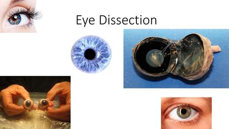 Eye Dissection.