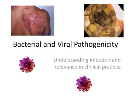 Bacterial and Viral Pathogenicity