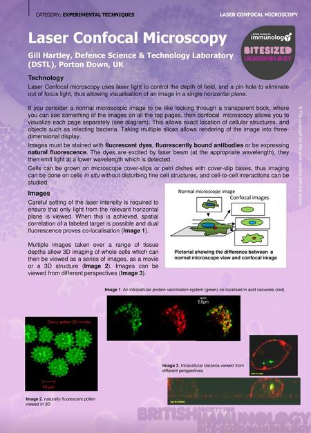 Laser Confocal Microscopy