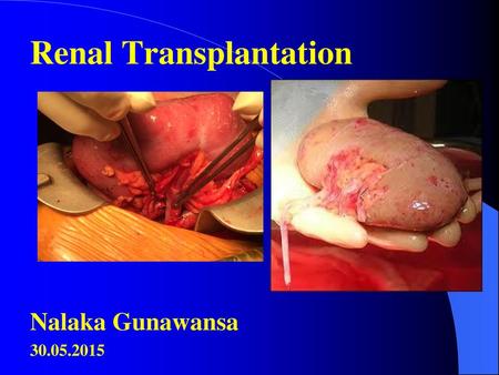 Renal Transplantation