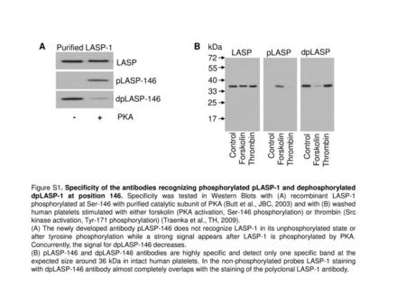 - + PKA A B Purified LASP-1 kDa LASP pLASP dpLASP 72 LASP 55 pLASP-146