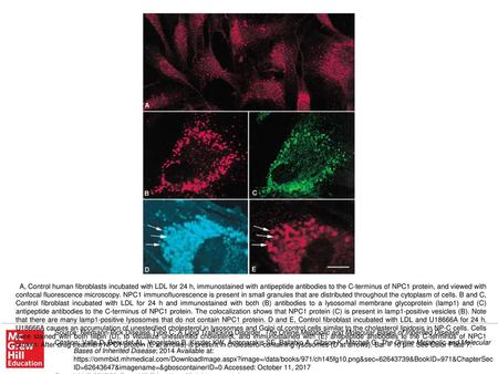 A, Control human fibroblasts incubated with LDL for 24 h, immunostained with antipeptide antibodies to the C-terminus of NPC1 protein, and viewed with.