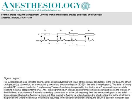 Anesthes. 2001;95(5): Figure Legend: