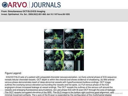 Figure Legend: From: Simultaneous OCT/SLO/ICG Imaging