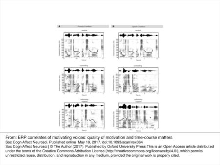 Fig. 1. Spectrograms. The illustration shows example spectrograms and waveforms for stimuli used. Panel A shows examples for the prosody condition (‘You.