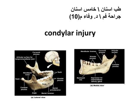 طب اسنان \ خامس اسنان جراحة فم \ د. وفاء م(10) condylar injury.