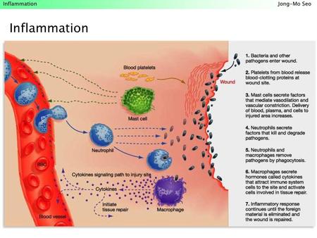 Inflammation.