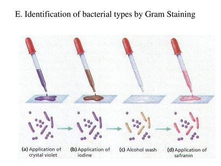 E. Identification of bacterial types by Gram Staining