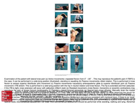 Examination of the patient with lateral knee pain (a) Active movements—repeated flexion from 0°–30°. This may reproduce the patient’s pain if ITBFS is.