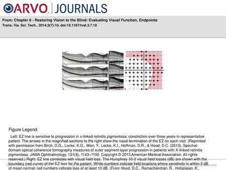 Trans. Vis. Sci. Tech ;3(7):10. doi: /tvst Figure Legend: