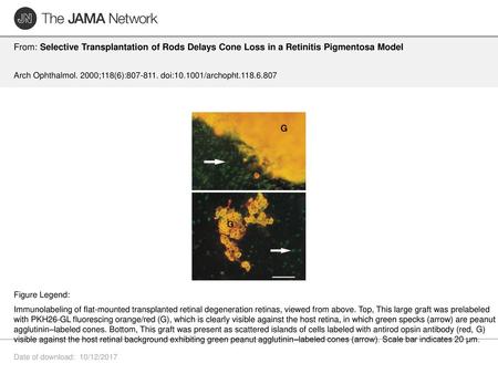 Arch Ophthalmol. 2000;118(6): doi: /archopht Figure Legend: