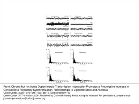 Figure 1. Characterization of the 4 states of vigilance