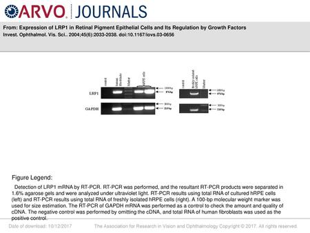 Invest. Ophthalmol. Vis. Sci ;45(6): doi: /iovs Figure Legend: