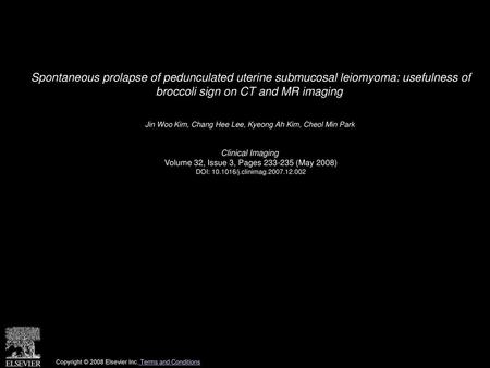 Spontaneous prolapse of pedunculated uterine submucosal leiomyoma: usefulness of broccoli sign on CT and MR imaging  Jin Woo Kim, Chang Hee Lee, Kyeong.