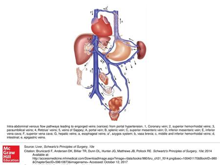 Intra-abdominal venous flow pathways leading to engorged veins (varices) from portal hypertension. 1, Coronary vein; 2, superior hemorrhoidal veins; 3,