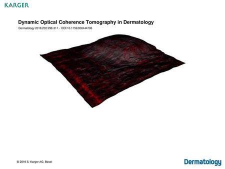 Dynamic Optical Coherence Tomography in Dermatology