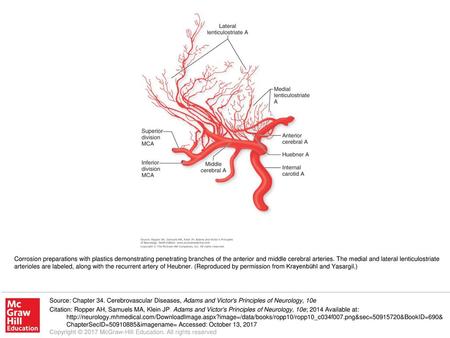 Corrosion preparations with plastics demonstrating penetrating branches of the anterior and middle cerebral arteries. The medial and lateral lenticulostriate.