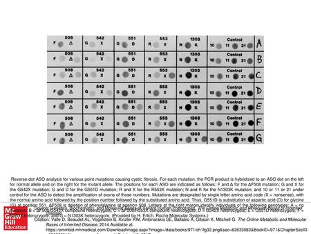 Reverse-dot ASO analysis for various point mutations causing cystic fibrosis. For each mutation, the PCR product is hybridized to an ASO dot on the left.