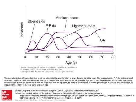 The age distribution of knee disorders is given schematically as a function of age. Blount's ds, tibia vara; OA, osteoarthrosis; P-F ds, patellofemoral.