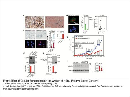 Figure 4. Naturally occurring senescent cells from a HER2-expressing patient-derived xenograft secrete IL-6, which is required for tumor growth. A ) A.