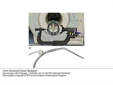 From: Advanced Cranial Navigation