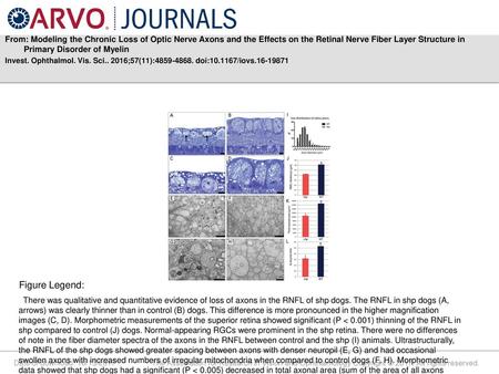 From: Modeling the Chronic Loss of Optic Nerve Axons and the Effects on the Retinal Nerve Fiber Layer Structure in Primary Disorder of Myelin Invest. Ophthalmol.