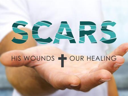 HIDDEN SCARS Luke 8: HIDDEN SCARS Jairus He was in so much pain he was unaware.