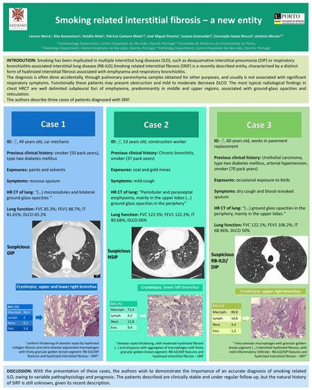 Smoking related interstitial fibrosis – a new entity