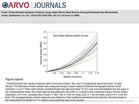 From: Finite Element Analysis Predicts Large Optic Nerve Head Strains During Horizontal Eye Movements Invest. Ophthalmol. Vis. Sci.. 2016;57(6):2452-2462.