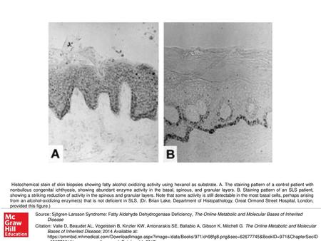 Histochemical stain of skin biopsies showing fatty alcohol oxidizing activity using hexanol as substrate. A. The staining pattern of a control patient.