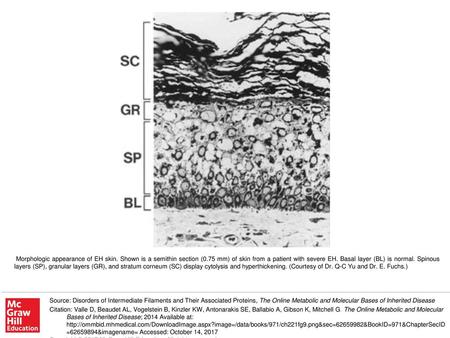 Morphologic appearance of EH skin. Shown is a semithin section (0