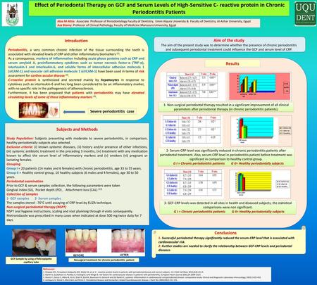 Effect of Periodontal Therapy on GCF and Serum Levels of High-Sensitive C- reactive protein in Chronic Periodontitis Patients Alaa M Attia: Associate.