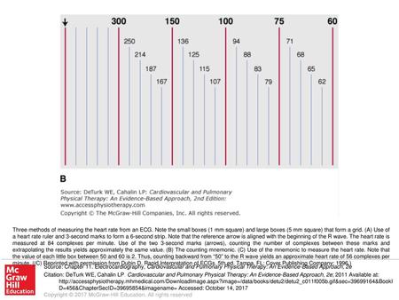 Three methods of measuring the heart rate from an ECG