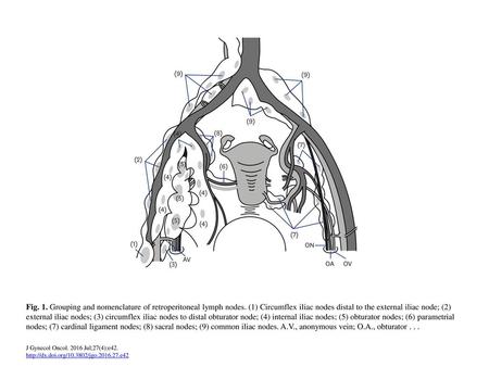 Fig. 1. Grouping and nomenclature of retroperitoneal lymph nodes