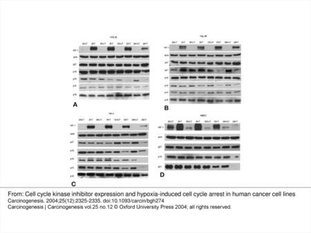 Fig. 3. Western blot analysis of cell cycle regulators reveals loss of at least one CDK inhibitor. 75 ug/lane of protein extracts were loaded onto 8%