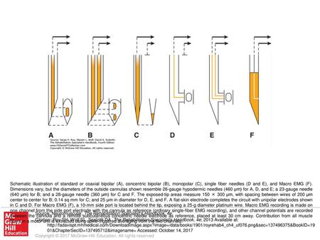 Schematic illustration of standard or coaxial bipolar (A), concentric bipolar (B), monopolar (C), single fiber needles (D and E), and Macro EMG (F). Dimensions.