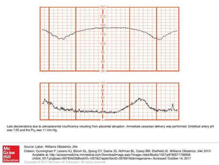 Late decelerations due to uteroplacental insufficiency resulting from placental abruption. Immediate cesarean delivery was performed. Umbilical artery.